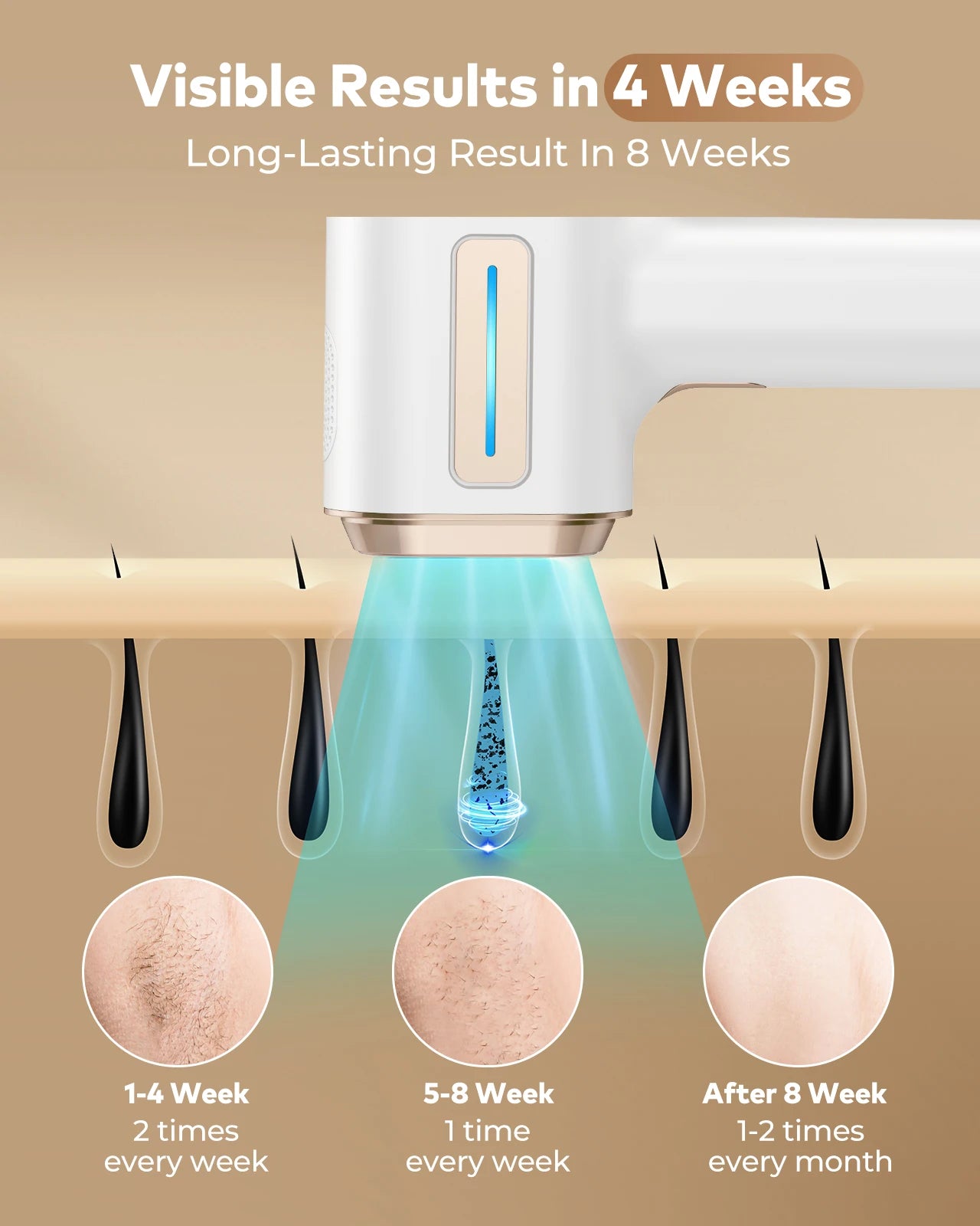 Depiladora IPL GlowiraSkin – Piel suave sin dolor, desde casa